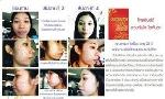 KOREGINS  DEE โกเรจินส์ ดี